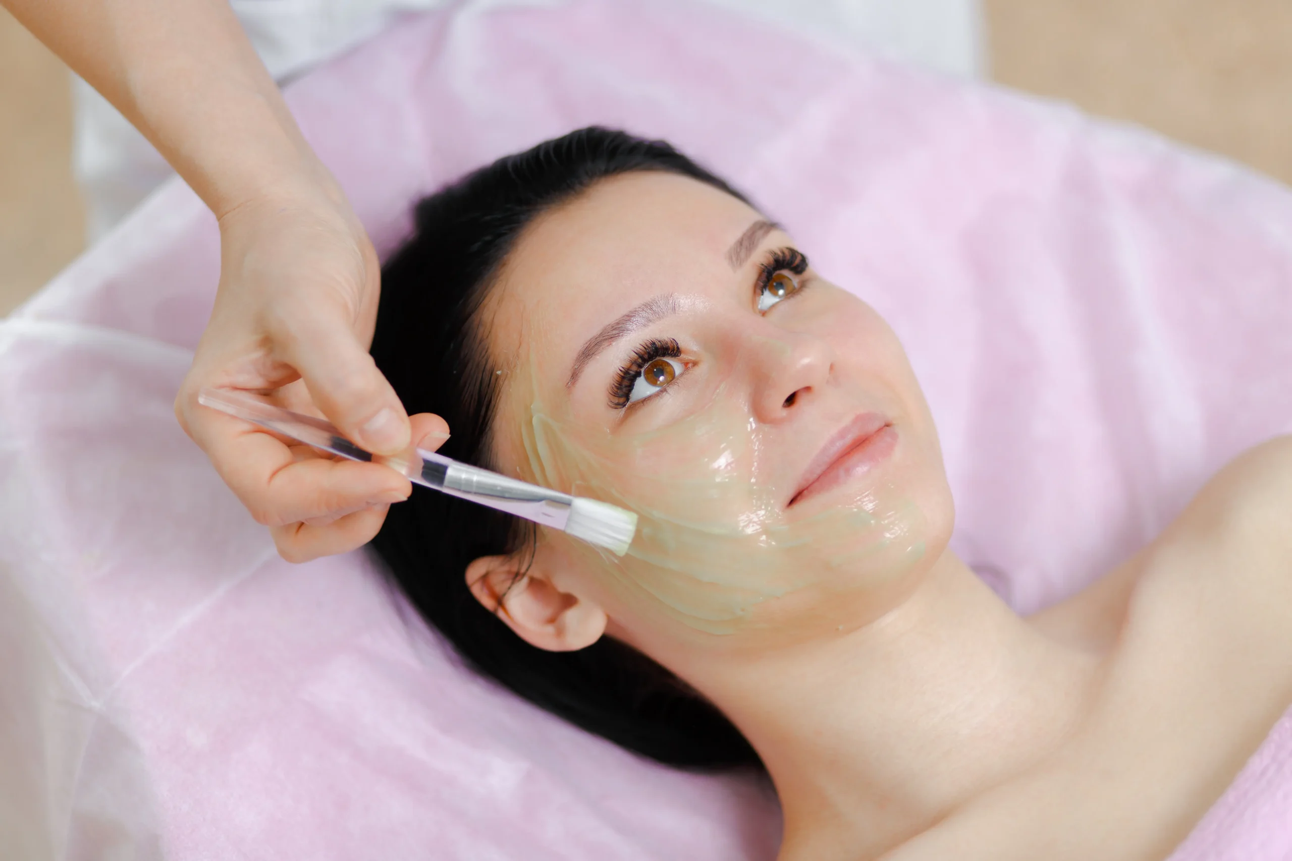 kimyasal-peeling-izmit_vasfiyeayhan